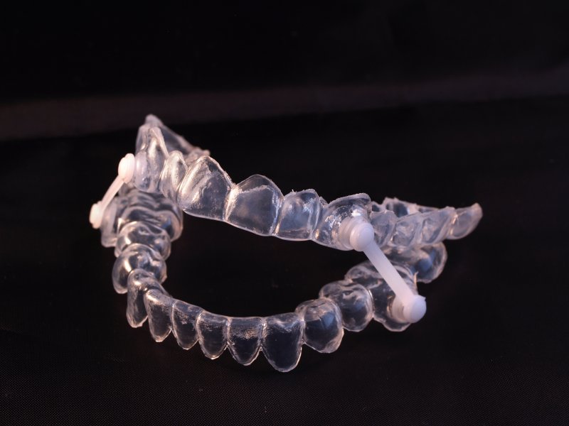 Oral Appliance for Sleep Apnea