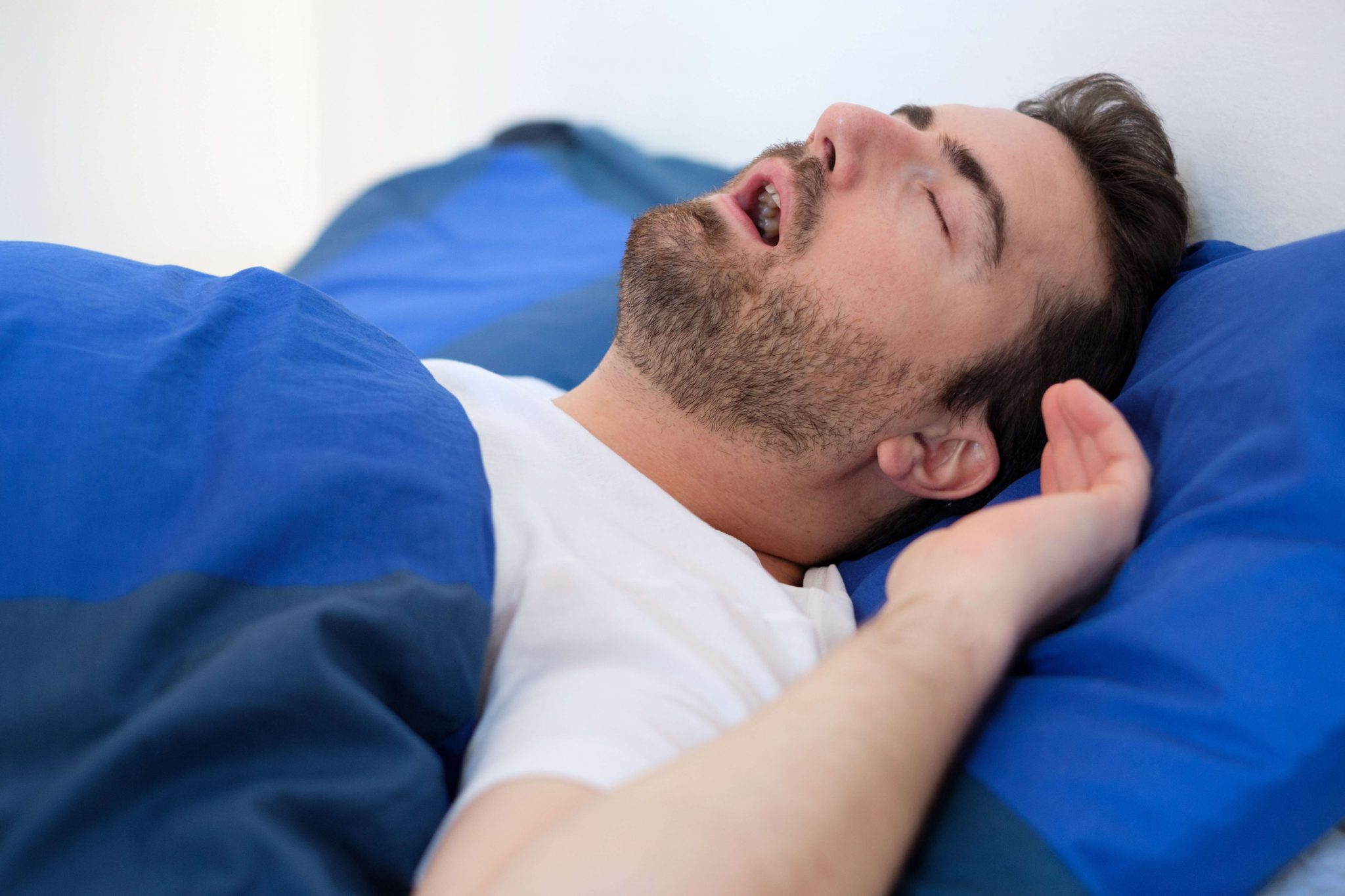 5 Fast and Simple Ways to Stop Snoring Florida Dental Sleep Disorders