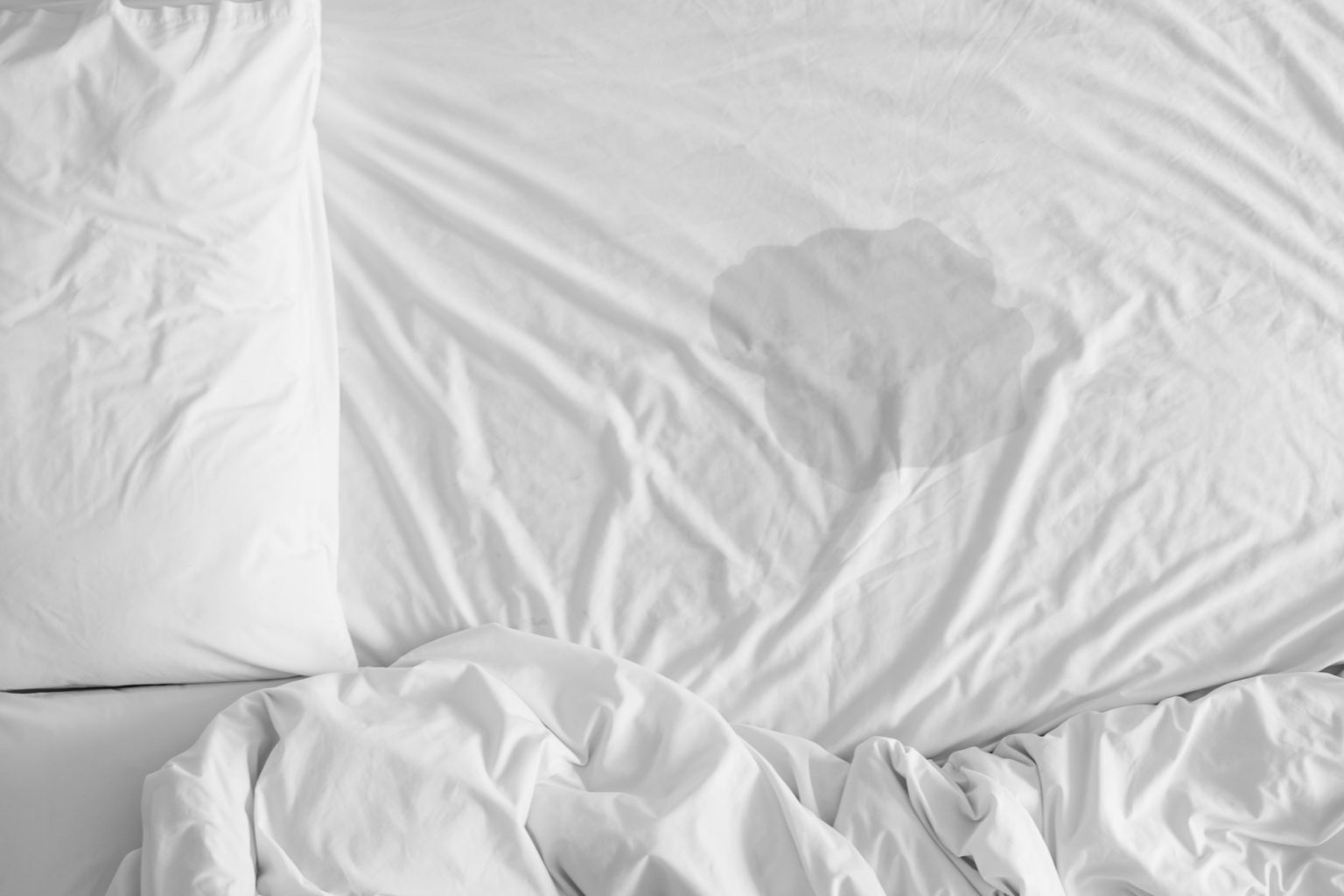 Bedwetting and Sleep Apnea Understanding the Connection Florida