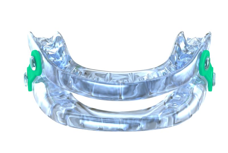 Adjusting to Your Oral Appliance 4 Helpful Tips Florida Dental Sleep Disorders